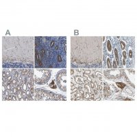 Anti-CLCC1 antibody produced in rabbit 