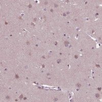 Anti-CLCN4 antibody produced in rabbit