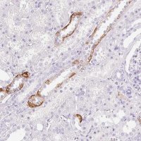 Anti-CLDN16 antibody produced in rabbit 