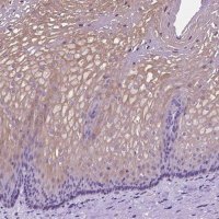Anti-CLDN17 antibody produced in rabbit