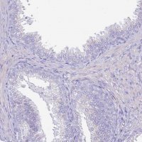 Anti-CLEC4M antibody produced in rabbit 