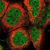 Anti-CLEC7A antibody produced in rabbit 