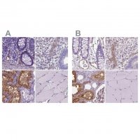 Anti-CLIC4 antibody produced in rabbit