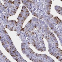 Anti-CLIC6 antibody produced in rabbit HPA055123-100UL
