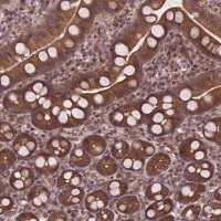 Anti-CLINT1 antibody produced in rabbit