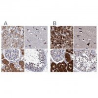 Anti-CLPB antibody produced in rabbit