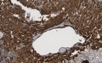 Anti-Clusterin chain Antibody, clone 41D ZooMAb� Mouse Monoclonal 