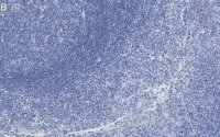 Anti-Clusterin Antibody, clone 2F23 ZooMAb® Rabbit Monoclonal