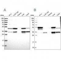 Anti-CLYBL antibody produced in rabbit 