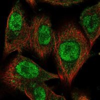 Anti-CMIP antibody produced in rabbit HPA054424-100UL