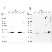 Anti-CMPK1 antibody produced in rabbit HPA053730-100UL