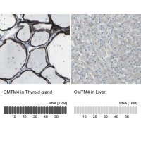 Anti-CMTM4 antibody produced in rabbit 