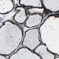 Anti-CMTM4 antibody produced in rabbit 
