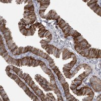 Anti-CMTM6 antibody produced in rabbit
