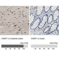 Anti-CNDP1 antibody produced in rabbit 