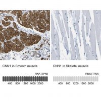 Anti-CNN1 antibody produced in rabbit 