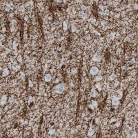 Anti-CNP antibody produced in rabbit HPA023266-100UL