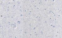 Anti-CNTNAP2 Antibody, clone 2D17 ZooMAb® Rabbit Monoclonal