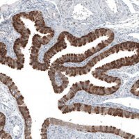 Anti-COL12A1 antibody produced in rabbit 