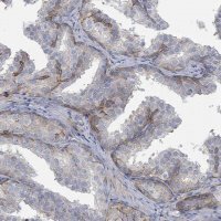 Anti-COL13A1 antibody produced in rabbit 