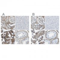 Anti-COL15A1 antibody produced in rabbit