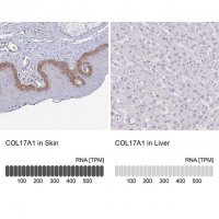 Anti-COL17A1 antibody produced in rabbit 