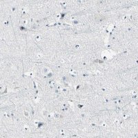 Anti-COL6A3 antibody produced in rabbit HPA010080-100UL