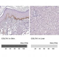 Anti-COL7A1 antibody produced in rabbit 