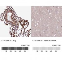 Anti-COL8A1 antibody produced in rabbit 