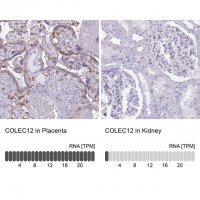 Anti-COLEC12 antibody produced in rabbit 