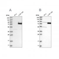 Anti-COLGALT2 antibody produced in rabbit HPA031750-100UL