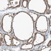 Anti-COMMD8 antibody produced in rabbit 