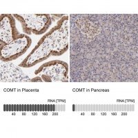 Anti-COMT antibody produced in rabbit HPA001169-100UL