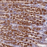 Anti-COMTD1 antibody produced in rabbit 