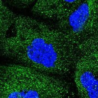 Anti-COQ2 antibody produced in rabbit HPA056599-100UL