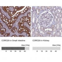 Anti-CORO2A antibody produced in rabbit HPA041161-100UL