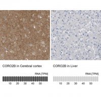 Anti-CORO2B antibody produced in rabbit