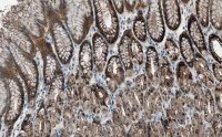 Anti-Cortactin Antibody, clone 1F15 ZooMAb� Rabbit Monoclonal 