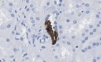 Anti-COX2 Antibody, clone 2B19 ZooMAb� Rabbit Monoclonal 
