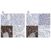 Anti-CPA2 antibody produced in rabbit