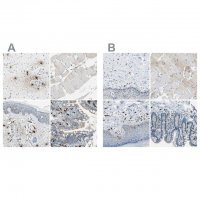 Anti-CPA3 antibody produced in rabbit 