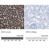 Anti-CPS1 antibody produced in rabbit