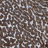 Anti-CPS1 antibody produced in rabbit