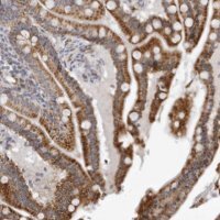Anti-CPT2 antibody produced in rabbit 