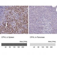 Anti-CPVL antibody produced in rabbit 