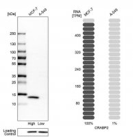 Anti-CRABP2 antibody produced in rabbit 