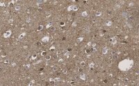 Anti-CRBN Antibody, clone 3I23 ZooMAb� Rabbit Monoclonal 