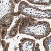 Anti-CREB3L2 antibody produced in rabbit 