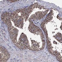 Anti-CREB3L4 antibody produced in rabbit 