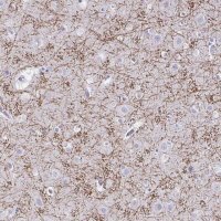 Anti-CREG2 antibody produced in rabbit 